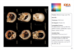 Película Médica de Alta Resolución Blanca para Impresión de Inyección de Tinta, Base PET, para Ultrasonido <span class=keywords><strong>y</strong></span> Endoscopia, Compatible con Impresoras Epson - Product Image 4