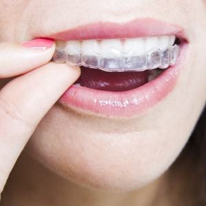 Bandeja bucal para blanqueamiento de dientes de uso doméstico Protector bucal EVA de grado alimenticio en caja de embalaje - Product Image 6