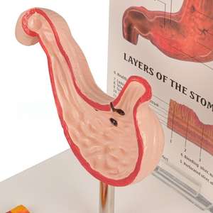Modèle d'enseignement médical Modèle de démonstration d'évolution de l'estomac pathologique, outil anatomique en PVC pour la formation en gastroentérologie - Product Image 2