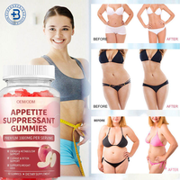 Gummies OEM Véganes Keto ACV pour Ventre Plat, Brûleur de Graisse, Bonbons Gommeux au Vinaigre de Cidre de Pomme, Suppresseur d'Appétit
