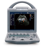 Color Doppler Ultrasound Machine Medical Diagnostic Imaging Equipment Portable 2d Ultrasound Scanner for Veterinary