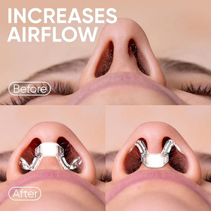 Dilatateurs nasaux anti-ronflement <span class=keywords><strong>pour</strong></span> un soulagement respiratoire – Dilatateur nasal <span class=keywords><strong>de</strong></span> Chine - Product Image 6