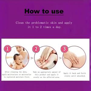 Hydratant quotidien pour les peaux sujettes à l'eczéma avec une formule d'extrait de plante améliore la barrière cutanée Pommade <span class=keywords><strong>contre</strong></span> l'eczéma pour bébé - Product Image 5