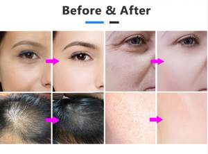 2026 Home Use High Frequency Face Eye Neck Lifting Beauty Device Electric <b>Massager</b> Skin Care Tool Anti-aging Waterproof - Product Image 4