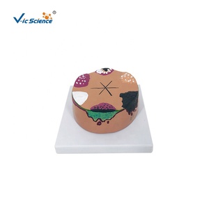 बच्चों के लिए त्वचा कैंसर शारीरिक शिक्षा मॉडल मैनिकिन प्लास्टिक/पीसी - Product Image 2