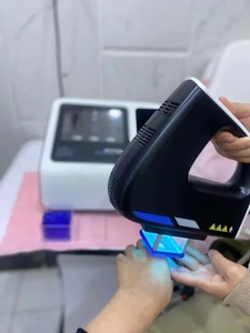 Mesin Laser Excimer Intensitas Tinggi 308nm Kernel KN-5000D - Portabel Desktop Perawatan Efektif untuk Kulit Vitiligo Psoriasis - Product Image 4