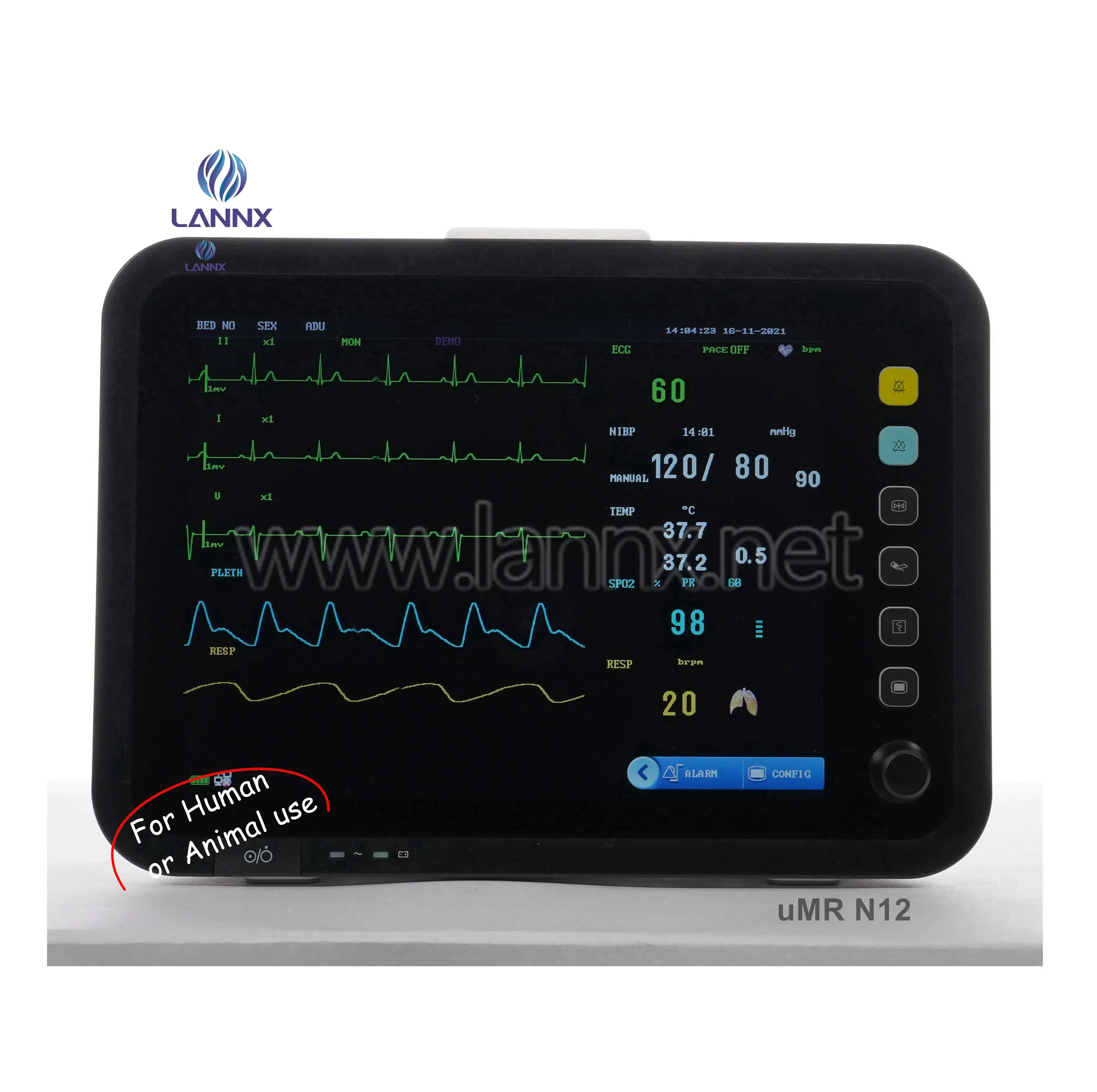 LANNX uMR N12 Entrega Rápida ICU equipamento médico multi-parâmetro animal humano Monitor Paciente ECG portátil sinais vitais monitor