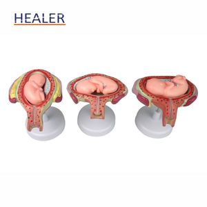 Mô hình sinh sản khoa học y tế Mô hình giải phẫu nữ cho sự phát triển của phôi thai và tử cung của thai nhi - Product Image 4