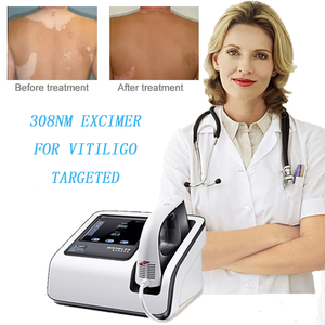 Apparecchiatura per la Cura della Pelle con Eccimeri 308nm per Vitiligine, Psoriasi, Eczema e Dermatite Atopica Senza Dolore - Product Image 1