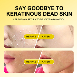 CHIC BEAUTE <span class=keywords><strong>Gel</strong></span> Exfoliante Espumoso de Limón, Purifica la Piel, Elimina Células Muertas y Sebo, Desobstruye los Poros, Exfoliante Facial Calmante - Product Image 4