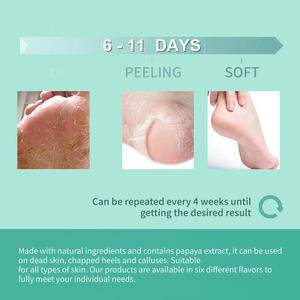 Icesea Best Selling Moisturising Collagen Magic Foot Peel  Private Label Beauty Exfoliating Foot  OEM/ODM - Product Image 5