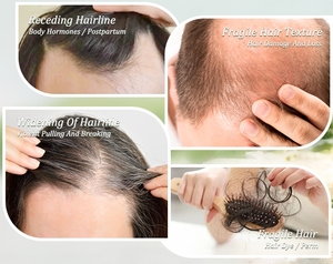 OEM ODM Productos Coreanos para el cuidado del cabello Champú y acondicionador de biotina de cebolla roja nutritiva e hidratante profunda para cabello de belleza - Product Image 2