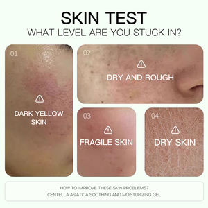 Gel Lenitivo Aiooce Centella Cica 97% Idratante Nutriente Calmante con Platano Asiatico - Product Image 4