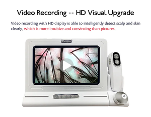 Máquina Analizadora de Piel y Cabello, Analizador de Cuero Cabelludo, Analizador de Piel y Cabello con IA - Product Image 4