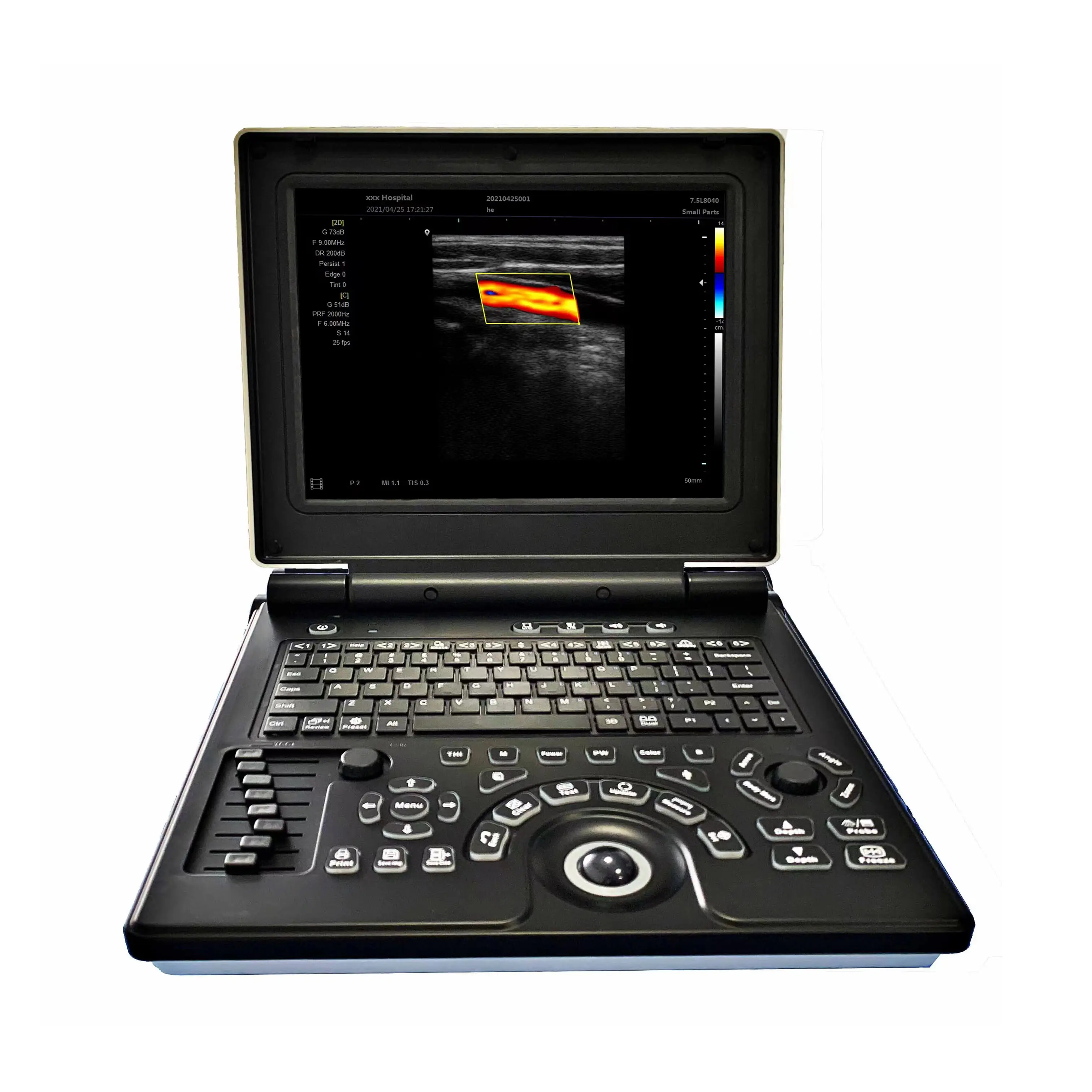 China más barato portátil 3D/4D Color Doppler ultrasonido eco máquina, sistema de ultrasonido de diagnóstico para clínica MSLCU02