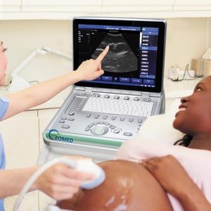 Appareil vétérinaire clinique hospitalier, échographe dynamique en temps réel de type ordinateur portable LCD 15 pouces avec sonde BW10 - Product Image 6