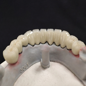Ponts et couronnes en céramique en métal PFM laboratoire dentaire chinois meilleur <span class=keywords><strong>prix</strong></span> de fabrication bon marché - Product Image 4
