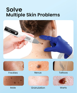 2025 xu hướng mới tự động loại bỏ thẻ da công cụ Kit không đau da nhãn nốt ruồi mụn cóc loại bỏ Bút chăm sóc da mặt công cụ làm đẹp - Product Image 6