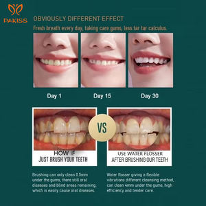 <span class=keywords><strong>Irrigador</strong></span> <span class=keywords><strong>Dental</strong></span> inalámbrico con chorro de agua, nuevo diseño, 2023 - Product Image 5