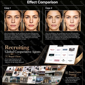 Nuovo Dispositivo di Bellezza Personalizzato per il <span class=keywords><strong>Viso</strong></span>, Macchina Professionale per Rassodamento della Pelle e Lifting Facciale, Uso Dermatologico in Salone - Product Image 5