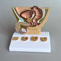 Modèles anatomiques du système urinaire masculin pour la science médicale, modèle de bassin masculin humain avec section de pathologie de la prostate