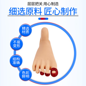 Modelo Avanzado para el Cuidado de Pies Diabéticos/Enfermos; Modelo de Cambios Patológicos del Pie; Ayuda Didáctica para la Enseñanza de Infecciones en los Dedos del Pie - Product Image 3
