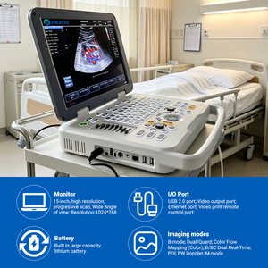 Ecógrafo Portátil Doppler Color, Escáner <span class=keywords><strong>de</strong></span> Diagnóstico Médico para Hospitales, Clínicas, Obstetricia y Ginecología - Product Image 6