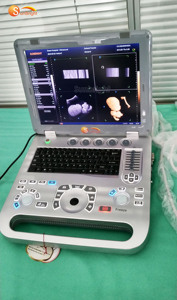 <span class=keywords><strong>Precio</strong></span> Más Bajo para Laptop con Máquina <span class=keywords><strong>de</strong></span> Ultrasonido Doppler 3D para Uso Veterinario en Perros SUN-800F2 - Product Image 3