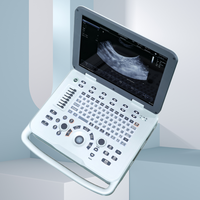 Équipement d'échographie vétérinaire SONOIMAGE D20, appareil médical reconnu CE, équipé d'un écran haute définition et de précision.