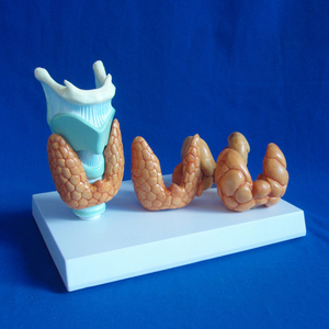 Modelo Anatómico de Tiroides Humano para Enfermedades de la Tiroides, Modelo Patológico para Ciencias Médicas - Product Image 3