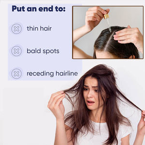 Suero para el Crecimiento del Cabello con Péptidos, Cuidado del Cuero Cabelludo, Nutre y Calma el Cuero Cabelludo, y Mejora la Vitalidad de los Folículos Pilosos - Product Image 6