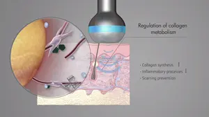 LDM Lokale Anti-Aging-Schönheits maschine für dynamische Mikromassage-Haut verjüngung