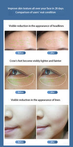 เครื่องยกกระชับใบหน้าด้วยคลื่นวิทยุแบบหยดน้ำ พร้อมวัสดุ ABS สำหรับการฟื้นฟูผิว ลดเลือนริ้วรอย และกระชับผิว - Product Image 6