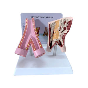 Modelo de Comparación de Vasos Sanguíneos Saludables y Vasos Sanguíneos Dañados por el Tabaco para la Enseñanza de Ciencias Médicas - Product Image 1