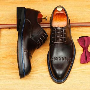 Zapatos de Hombre de Alta Gama, Formales, Transpirables, Modernos, con Cordones, de Piel Auténtica, Estilo Británico - Product Image 4