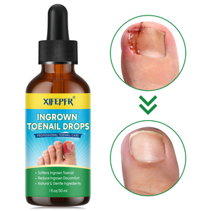Removedor de Unha Encravada Personalizado com Rótulo Privado, Corretor de Unha Encravada em Gotas 30ml/1.01 Fl.oz - Product Image 1