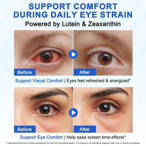 SOLOTREE Gomitas de Luteína, Suplementos de Vitaminas <span class=keywords><strong>y</strong></span> Minerales para la Vista, Sabor a Arándano, 8 mg de Zeaxantina, 40 mg de Luteína, Gomitas para la Salud Ocular - Product Image 4