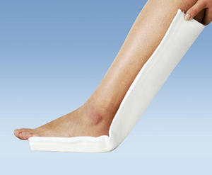 Calidad Hospital Cirugía Ortopédica Mano Pie Férula Fibra de vidrio Poliéster Férula - Product Image 2