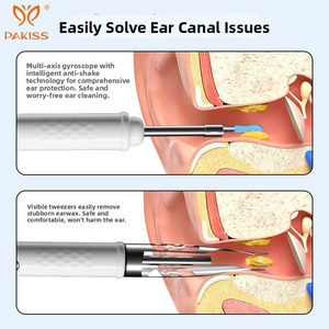 Kit de Limpieza de Oídos 3 en 1 PAKISS - Endoscopio Inalámbrico para Eliminar Cera de Oídos, Examen Bucal y del Cuero Cabelludo - Venta al por Mayor - Product Image 5