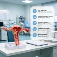 Modèle d'utérus pathologique grandeur nature en PVC, 2 parties, avec endométriose et cancer, pour l'enseignement en gynécologie, certifié CE ISO ROHS CNAS
