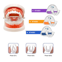 Trois étapes dentition redressement appareil dentaire dents meulage alignement accolades dent orthodontique orthèse bouche garde ensemble