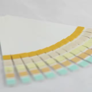 5-पैरामीटर मूत्र परीक्षण स्ट्रिप्स घर का उपयोग करें यूरिनलिसिस डुबकी-स्टिक किट (मॉडल URS-5K) - Product Image 6