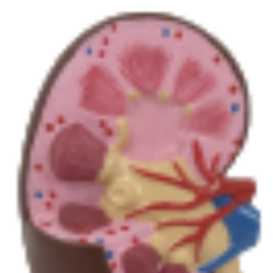Modelo de anatomía renal ADA Medical Science con modelo de glándula suprarrenal U022C/U022D, origen Shanghái, para entrenamiento y demostración de enfermedades - Product Image 3