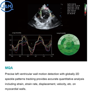 Échographe vétérinaire hospitalier avec TDI TEE Cardiaque MQA SonoScape ProPet 80 pour l'imagerie diagnostique myocardique des petits animaux - Product Image 6