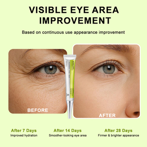 Serum Mata Retinol Peptide untuk Garis Halus, Kerutan, Mengencangkan, Menghilangkan Lingkaran Hitam, Perawatan Anti Penuaan OEM - Product Image 3