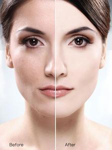 Señora <span class=keywords><strong>piel</strong></span> magia crema brillo pecas blanqueamiento crema pecas Tan placas Facial cuidado de la <span class=keywords><strong>piel</strong></span> más brillante suave punto eliminar crema - Product Image 5