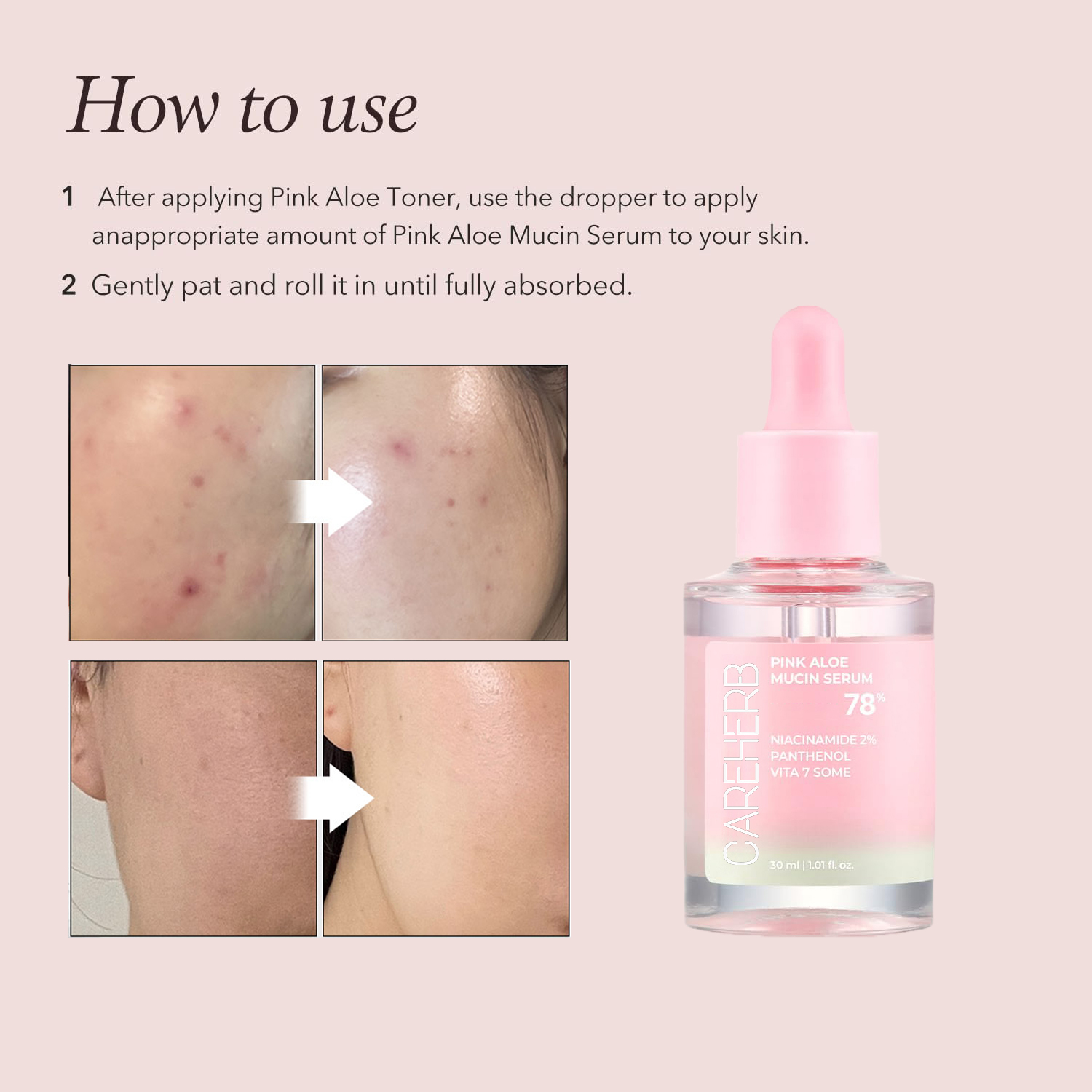 Srum nourrissant Pink Aloe Mucin pour corriger les taches cutanes