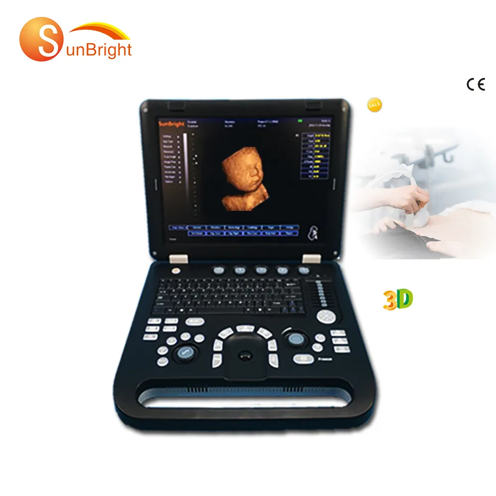 Hot SUN-800D laptop 3D color ultrasound system and color usg ultrasound machine with 3D function