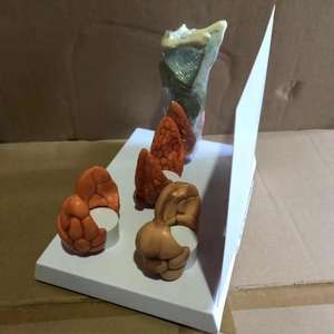 Modello di patologia tiroidea endocrinologia modello di visualizzazione della malattia della tiroide venduto come modello anatomico di scienza medica - Product Image 6