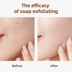 Best-seller all'ingrosso OEM ODM organico sapone alla curcuma artigianale per sbiancamento della pelle elimina gli acari e controlla l'olio - Product Image 2